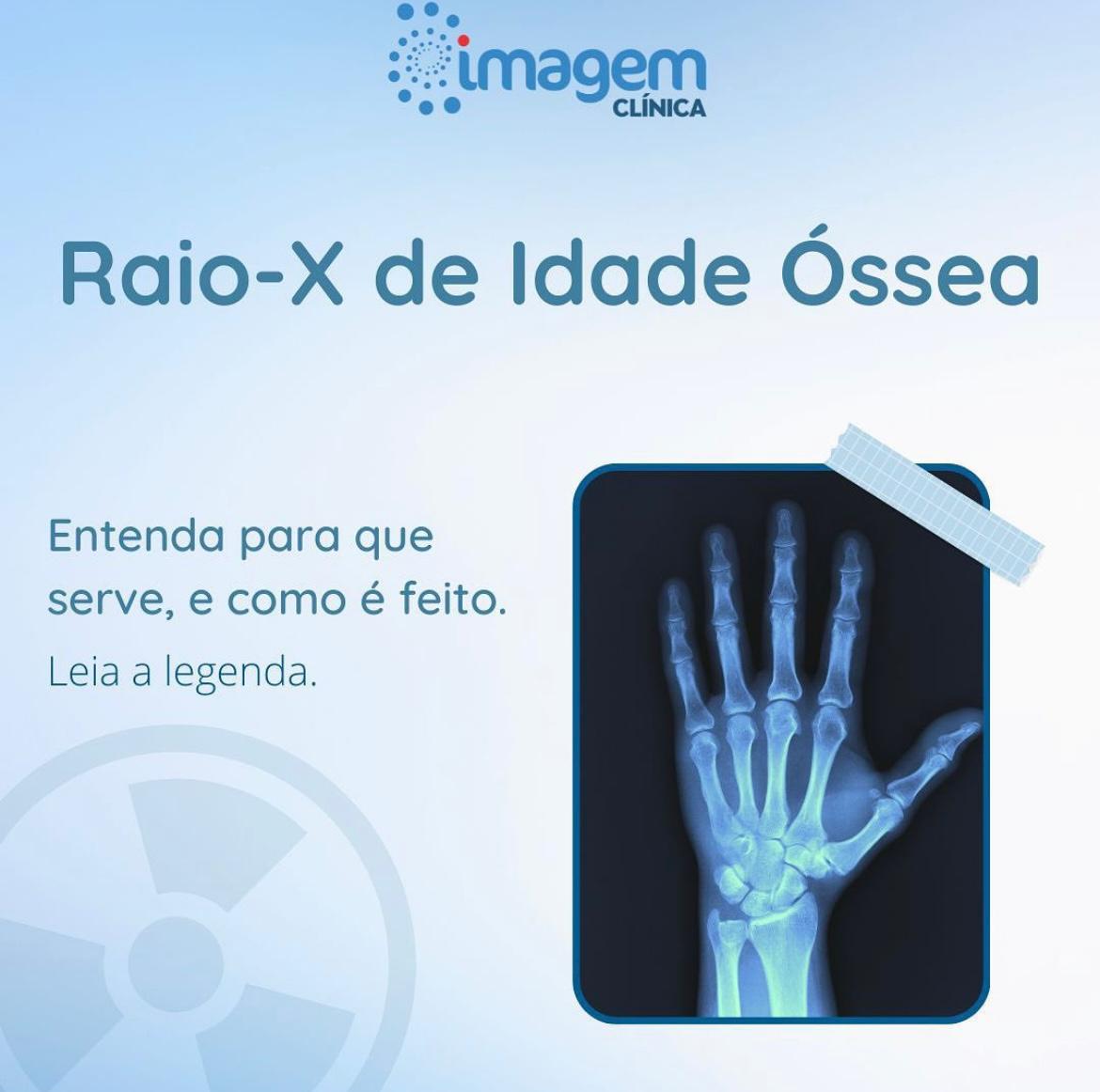 raio-x-idade-ossea