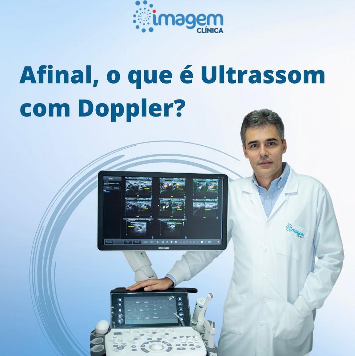 exame-ultrassom-doppler