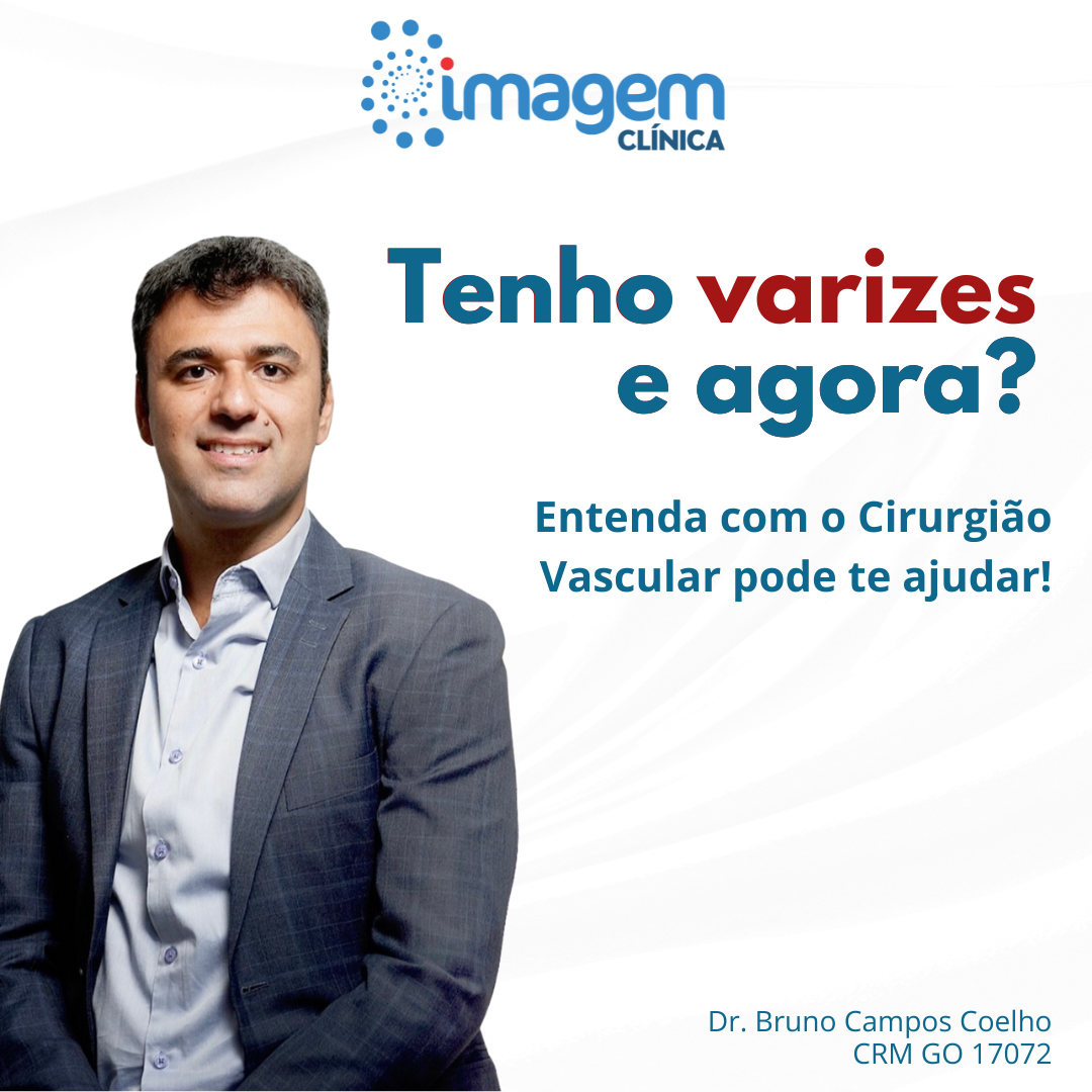 Tratamento de Varizes